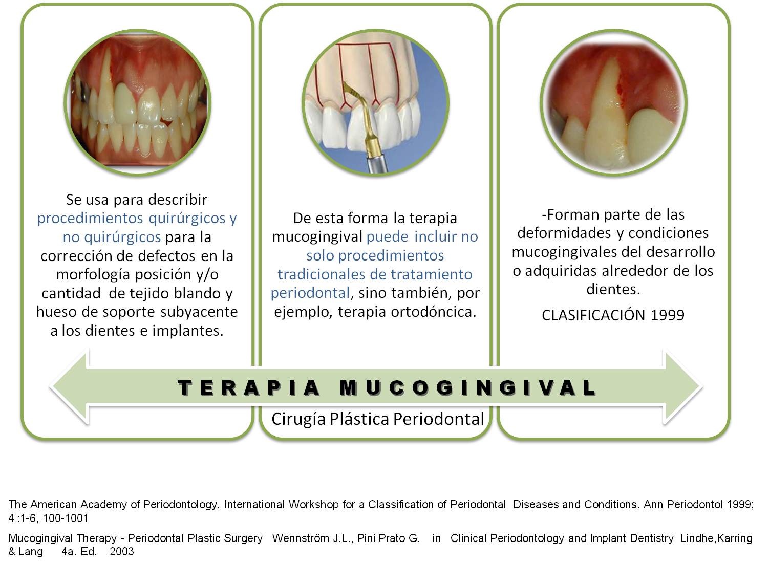 Que es la cirugia plastica periodontal